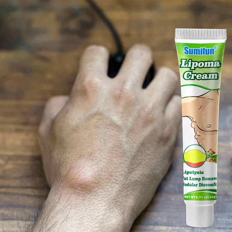 Sumifun Lipoma Cream - Natural Herbal Fat Lump Removal Ointment