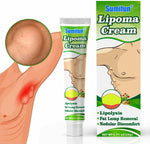 Sumifun Lipoma Cream - Natural Herbal Fat Lump Removal Ointment