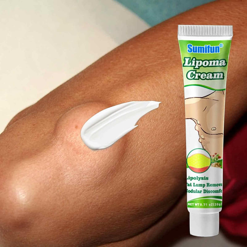Sumifun Lipoma Cream - Natural Herbal Fat Lump Removal Ointment