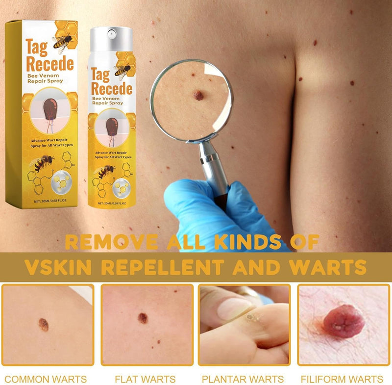 سبراي عسل النحل لعلاج الثآليل والعناية بالبشرة
