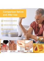 كريم سم النحل للمفاصل والعظام 30 جم